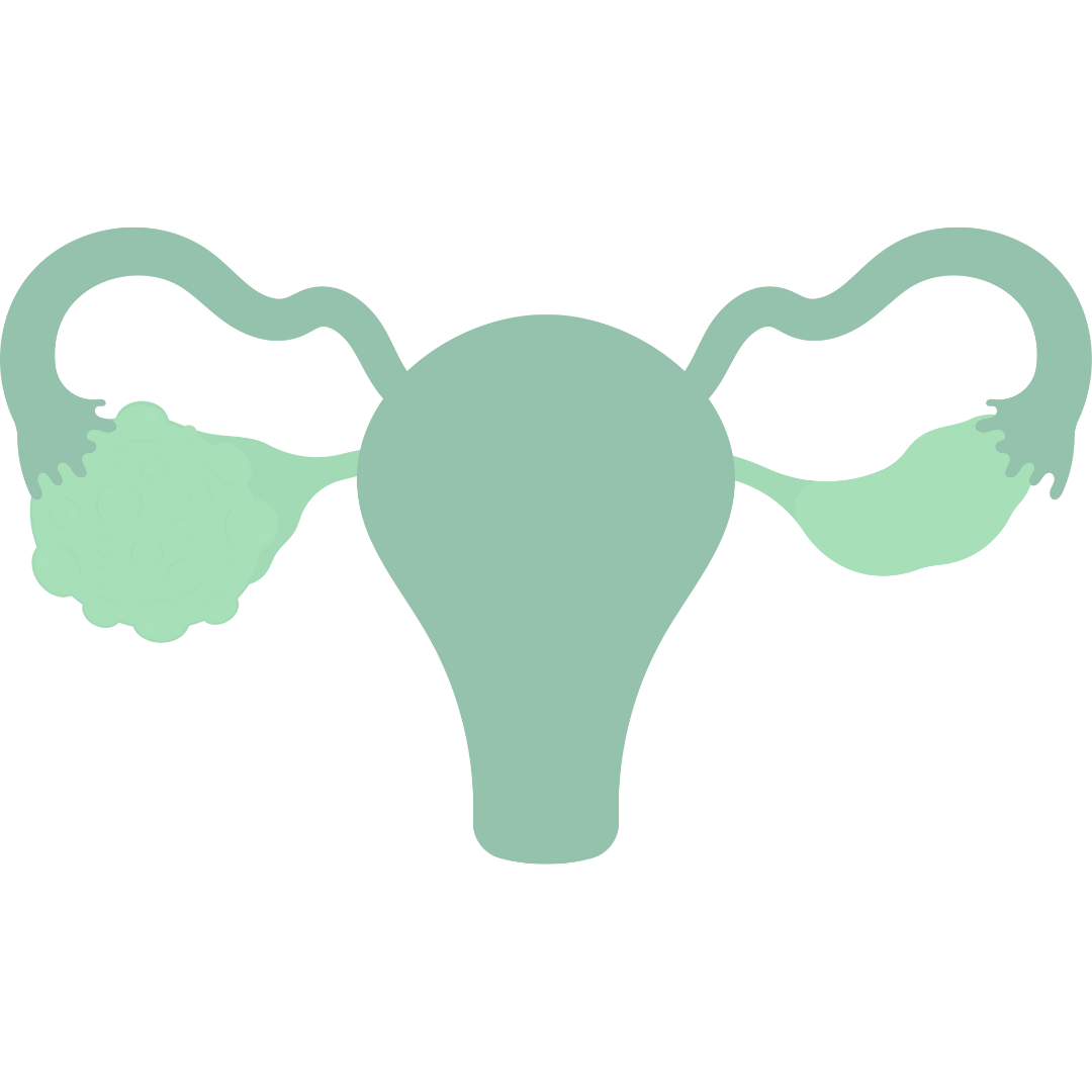 women_PCOS_PCOD